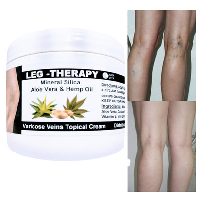 Varicose Vein Leg Therapy Relief Cream | Silica Hemp Seed Oil
