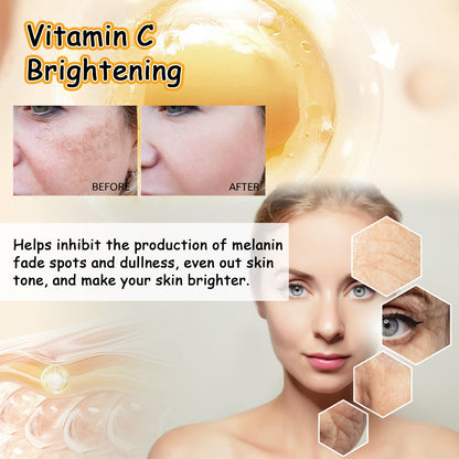 EELHOE Vitamin C Brightening Cream, Improve Drying To Reduce Fine Lines Held Acne Moist Brightens The Face Cream