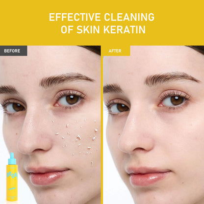 Phofay gentle peeling solution papaya enzyme