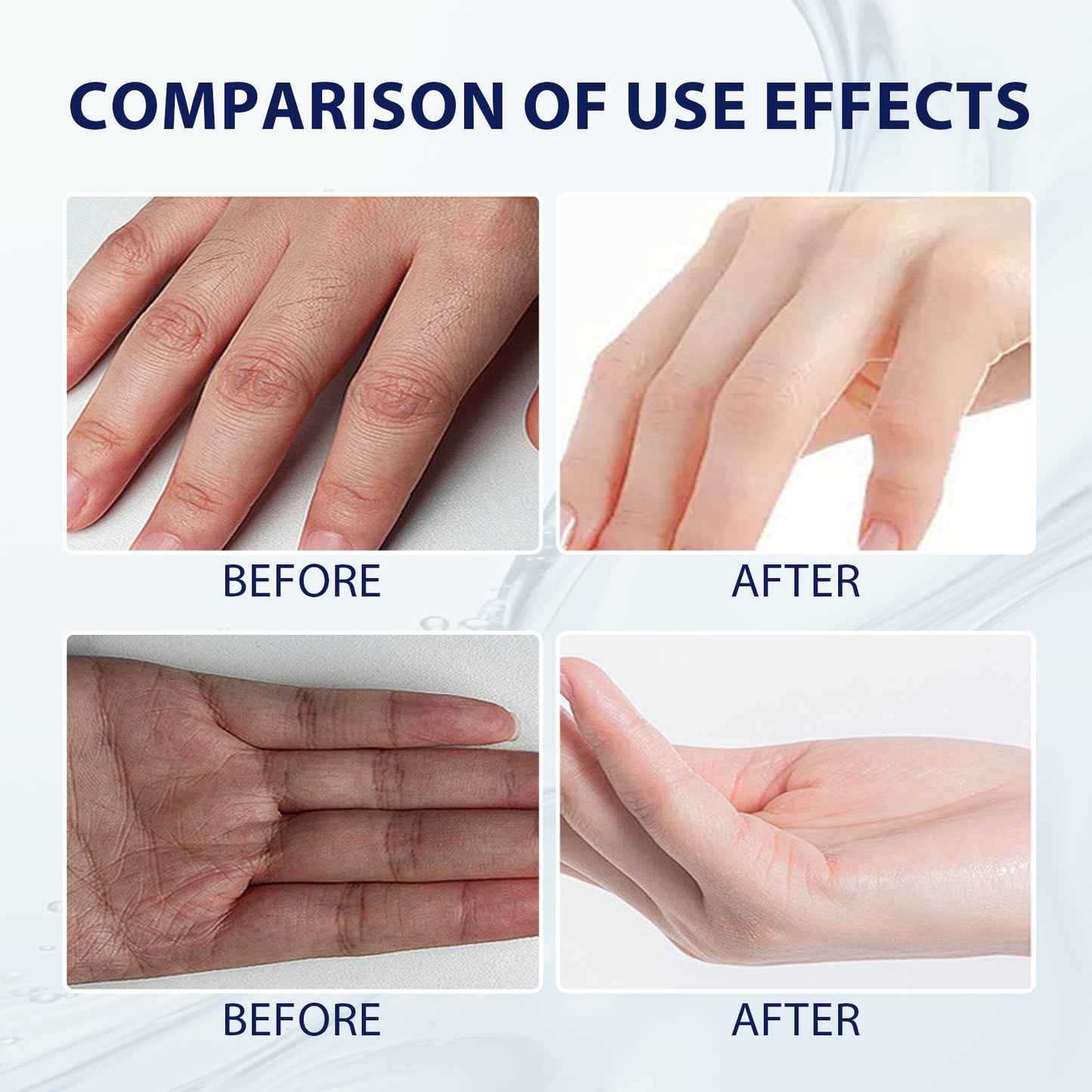OceAura Aloe Vera Care Gel, Hydrating And Refreshing Moisturizing Cream Prevents Dryness And Cracks To Repair Hand Skin
