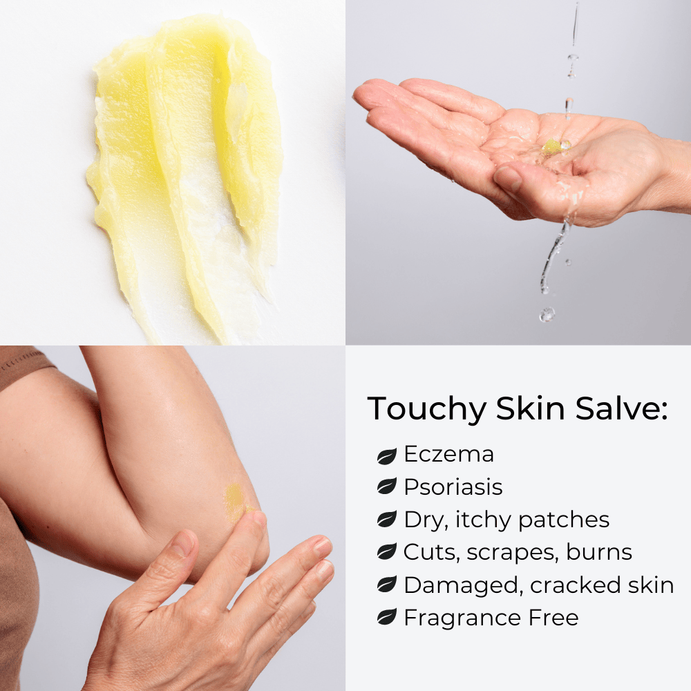 Touchy Skin Salve, Eczema Cream Ointment for Sensitive Skin